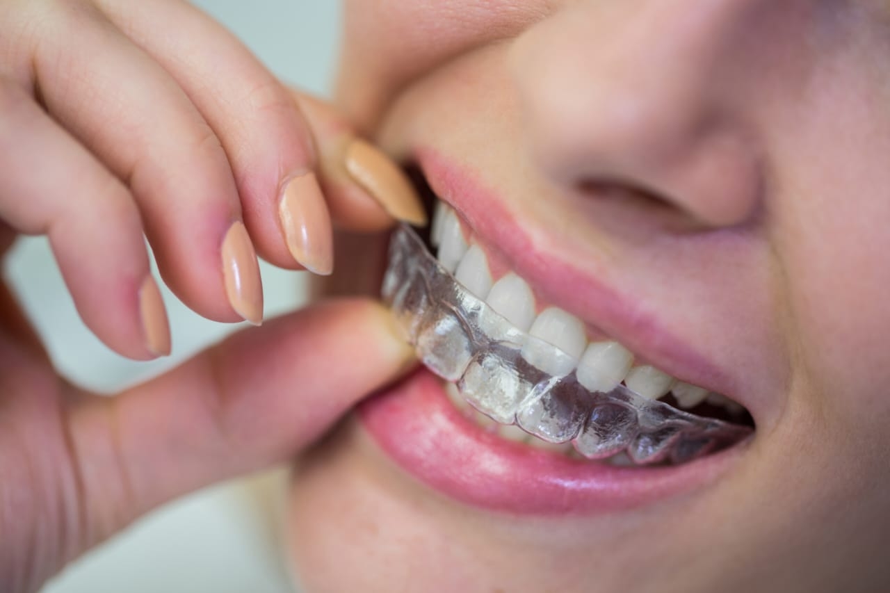 Dental clinic for invisible braces